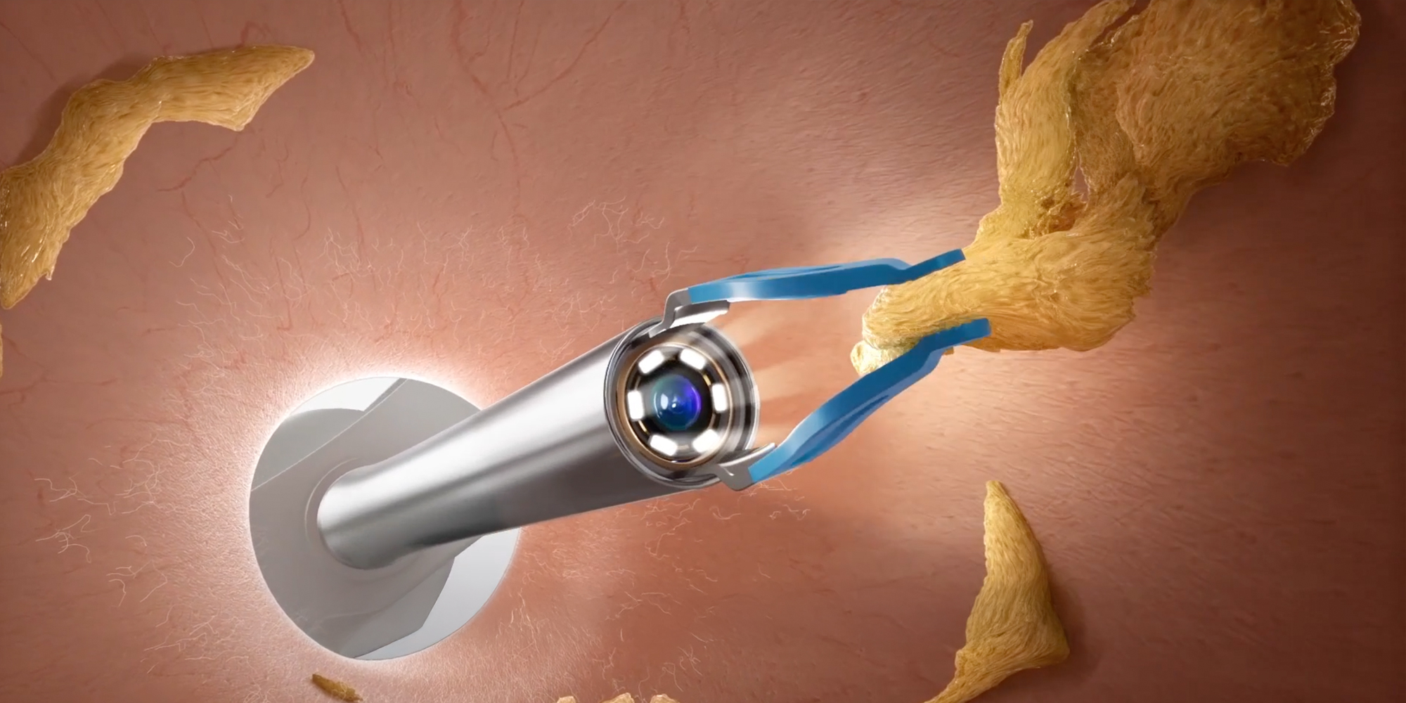 Urządzenie do czyszczenia uszu Bebird EarSight Plus I35R - niebieski