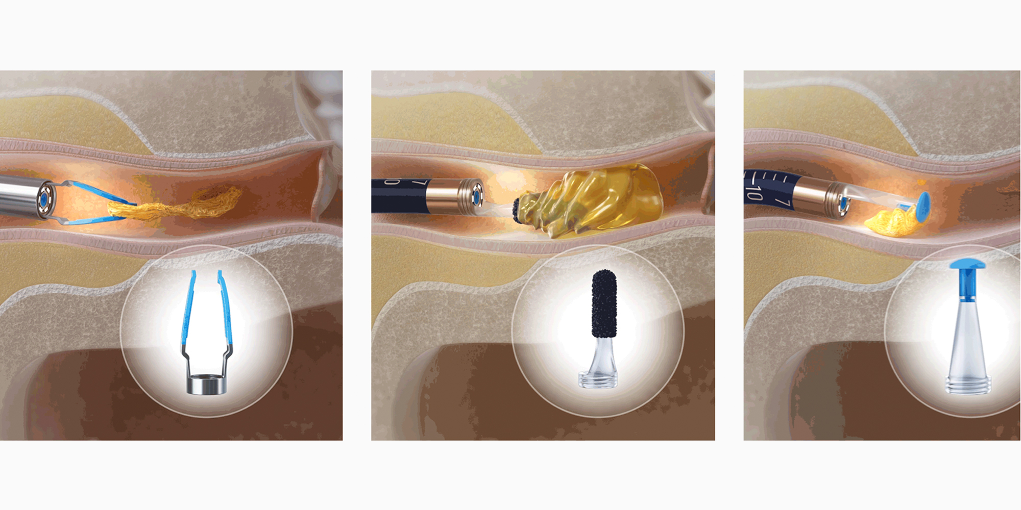 Urządzenie do czyszczenia uszu Bebird EarSight Plus I35R - niebieski - prezentacja działania końcówek