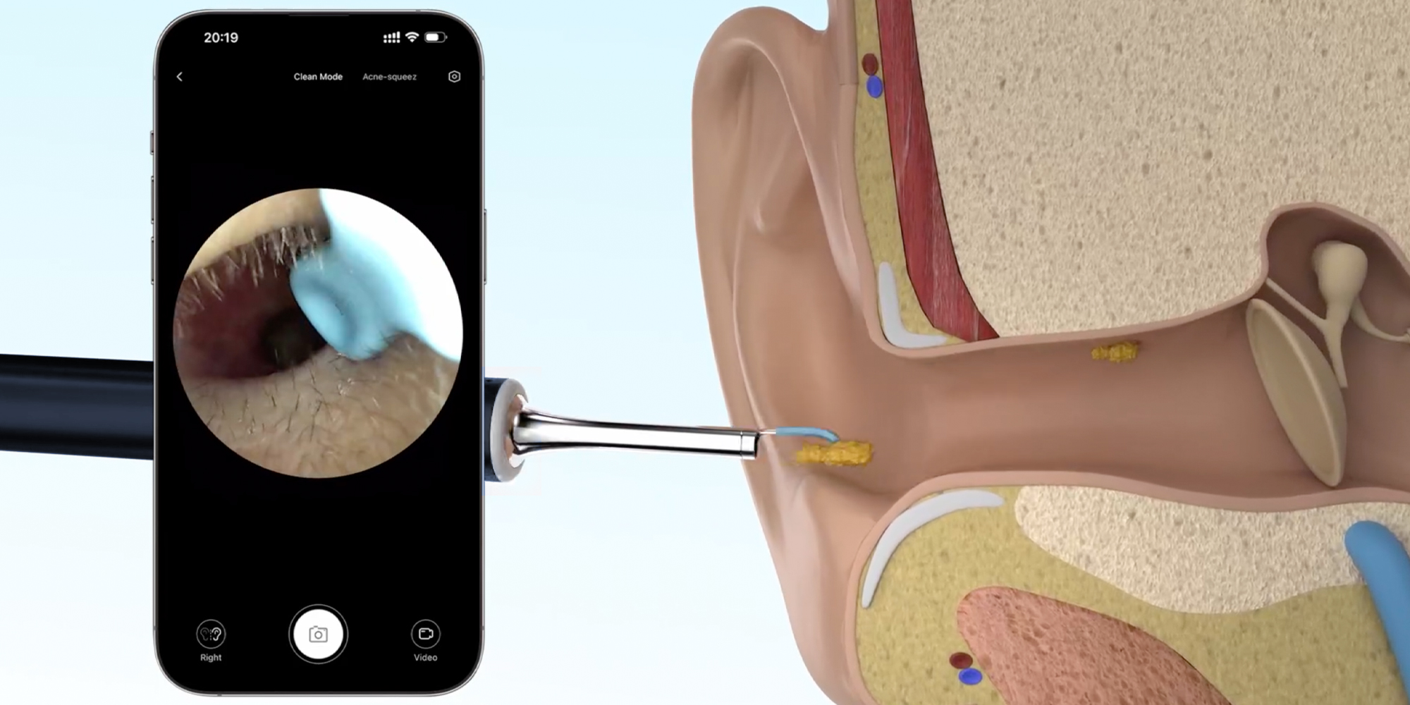 width=100% Urządzenie do czyszczenia uszu Bebird M9 S - niebieski